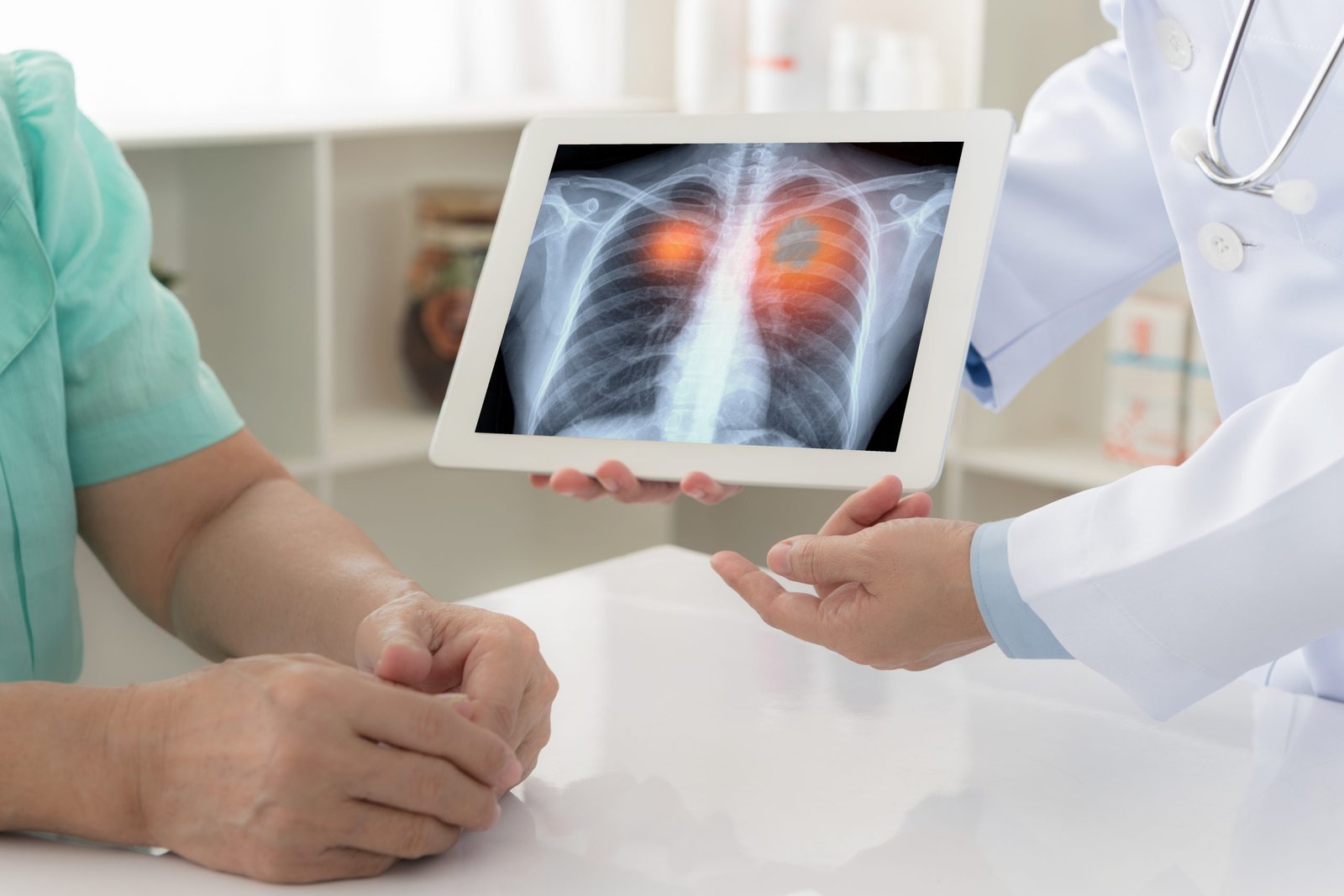Lung-Image-scaled-1