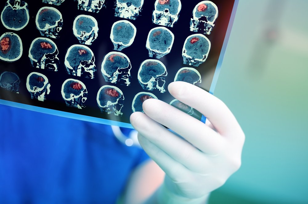 Doctor,Attentively,Examines,The,Mri,Scan,Of,The,Patient.
