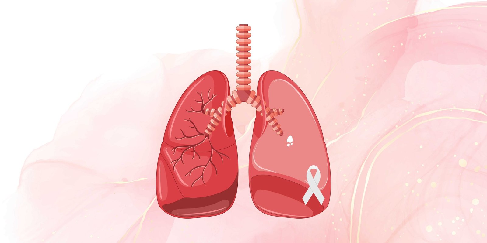 Lung Cancer